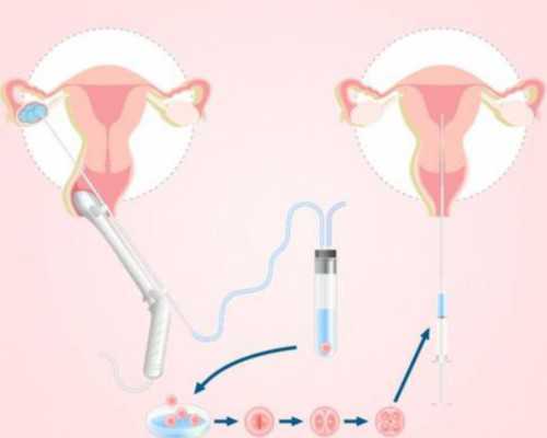 邯郸中心医院妇科检查套餐，邯郸市中心医院做供卵要预约吗？ 