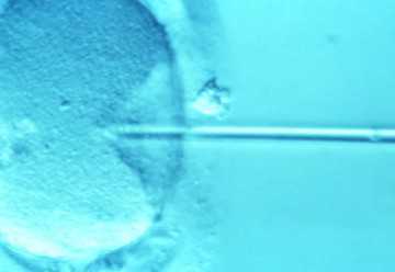 美国试管婴儿rsmc值得信赖，美国SCRC医院和国内做试管的流程有什么区别？ 