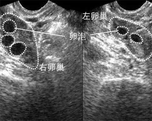 沈阳市试管婴儿医院，2024沈阳202医院试管婴儿谁做的好？ 