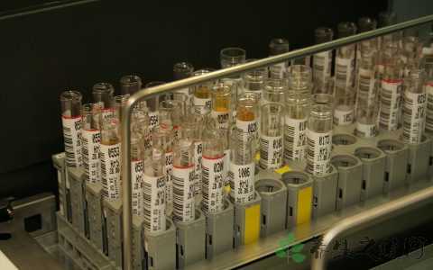 上海长征医院生殖中心三代试管，上海长征医院一代试管婴儿促排包括哪些项目？ 