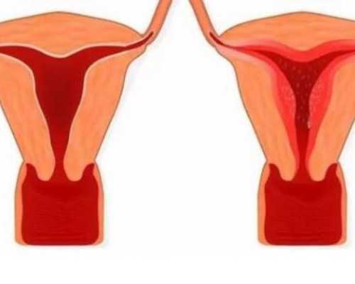 盛京医院可以全麻取卵了，2024盛京医院生殖中心取卵都是人工的吗？ 