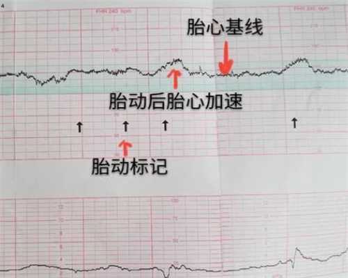 上海曙光医院产检好吗，上海曙光医院1代试管建档流程是什么？ 