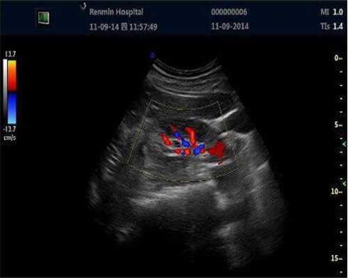 山东试管婴儿多少钱一次?，2024在山东做一代试管可以选择婴儿性别吗? 