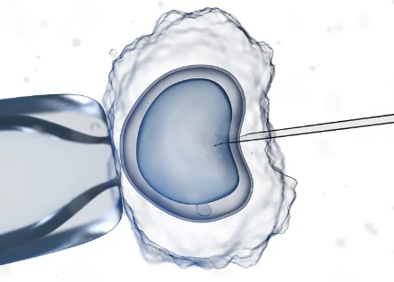格鲁吉亚供卵试管婴儿攻略，国内的格鲁吉亚的助孕套餐有哪些?哪个划算? 