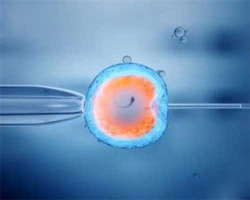 上海中山医院试管婴儿费用，上海中山医院做试管要住院吗？ 