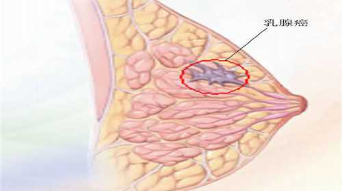 瑞金医院试管哪个医生好，瑞金医院试管群在哪里？ 