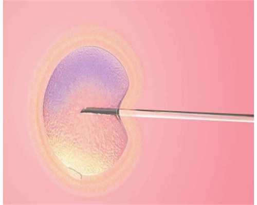 揭阳市试管婴儿医院，2024揭阳试管婴儿成功率排名前三的医院有哪些？ 