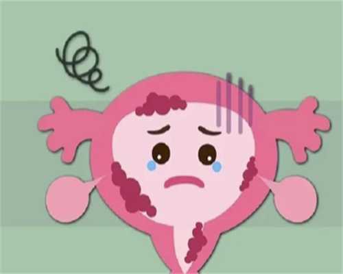 北医三院生殖中心初诊检查项目，北医三院生殖科阴超水平准确吗？ 