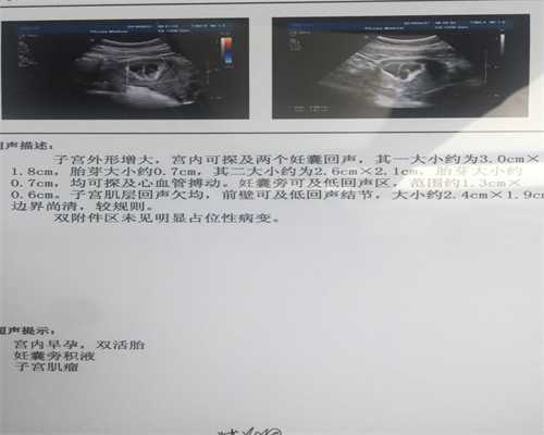 重庆新桥医院1代供卵试管进周检查费用多少一次，重庆新桥医院1代供卵试管进周检查费用多少？ 