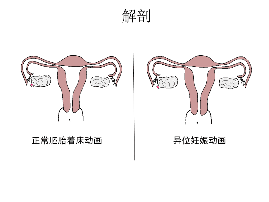 30岁可以捐卵吗，30岁的能不能冻卵？这项技术有年龄限制吗？ 