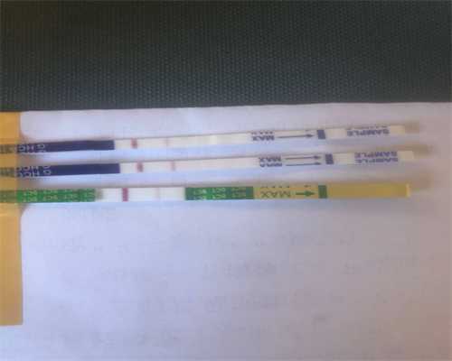 请问上海瑞金医院，2024上海瑞金医院什么最出名？ 