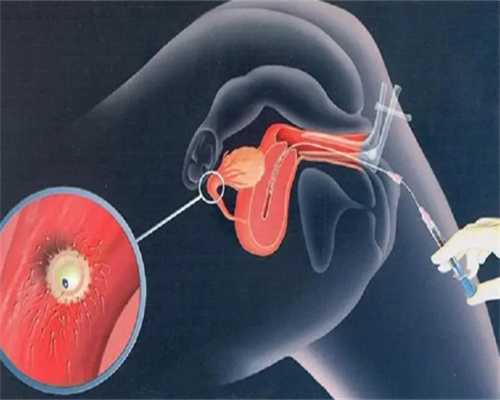 山西省妇幼可以做三代试管吗，山西省妇幼一代试管转二代试管流程是什么样的？ 