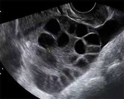 燕达医院生殖中心主任，2024燕达医院生殖科试管婴儿促排一次花多少钱？ 