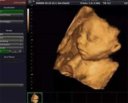 北京协和查染色体挂什么科，北京协和医院染色体平衡易位检查多少钱？ 