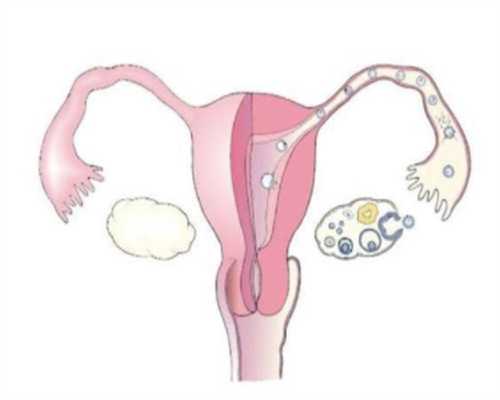 试管婴儿：弱精症患者适合做几代试管？二代试管的优点与成功率揭秘