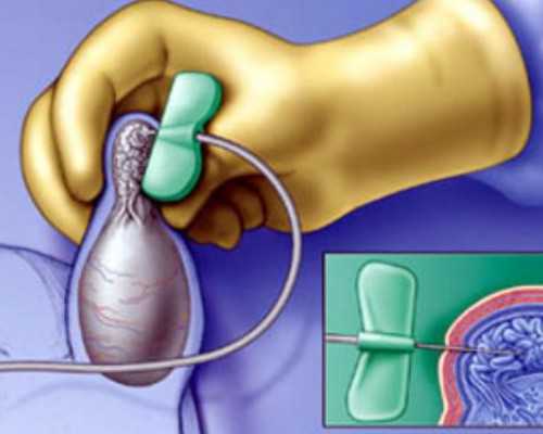 2020年生三胎奖励在哪里领取，2024年生三胎国家奖励的2万元怎么领取？ 