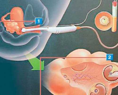 赤峰市妇产医院生殖科魏景艳和白立鹏哪个医生好，赤峰市妇产医院生殖科魏景艳和白立鹏哪个医生好？ 