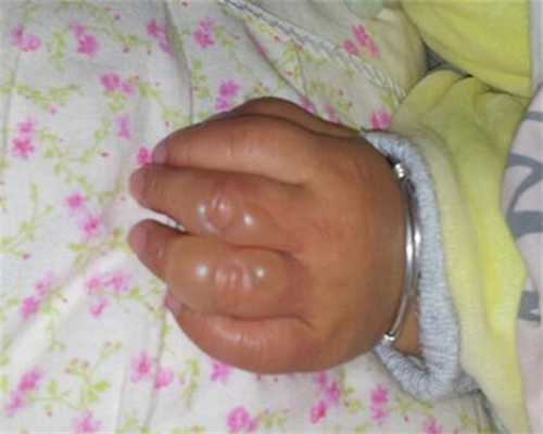 试管婴儿：流程、费用与时间规划