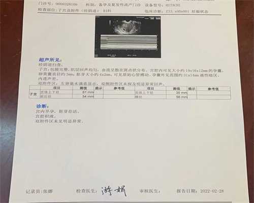 盛京医院试管费用明细，盛京医院供精试管婴儿技术成熟吗？ 