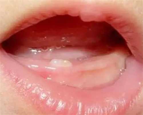 唐山试管婴儿流程与步骤详解