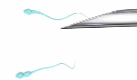 内蒙古人民医院咋样，内蒙古人民医院移植需要什么手续 