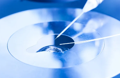 试管移植2枚鲜胚双胞胎概率高吗，重医附二院一代试管移植两个鲜胚前要住院吗？ 