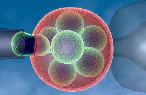 一妇婴取卵为什么不全麻，上海一妇婴取卵移植都是伍圆圆吗？ 