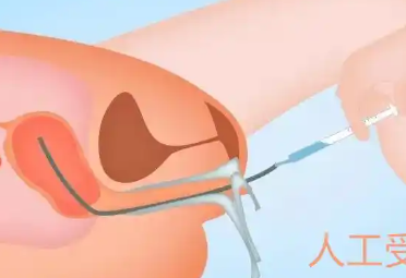 大连妇产医院哪位专家好，大连妇产医院胚胎移植费用高吗？ 