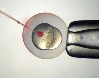 中山一院试管三代成功率高吗，2025中山一院试管婴儿攻略，费用估算及成功率参考