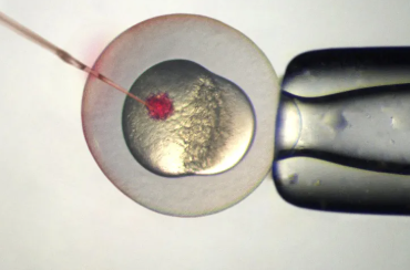 多囊拖着不治疗会怎样，女性多囊卵巢拖久了后果很严重！不孕只是其中症状之一