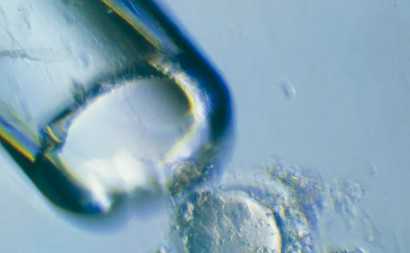 潍坊妇幼保健院24小时免费咨询，潍坊妇幼保健院