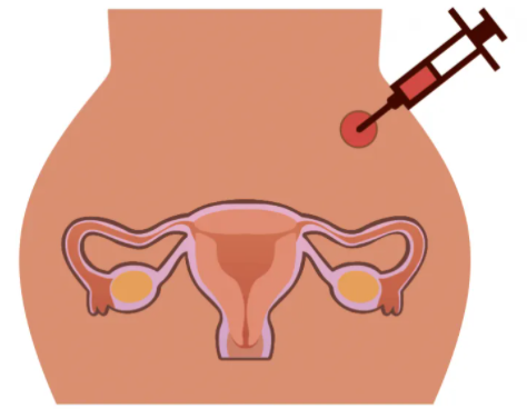 32周产检都检查什么项目，孕32周第六次产检指南！一文读懂具体项目及费用明细