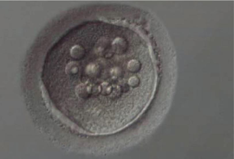 乌克兰做试管婴儿骗局，乌克兰ISIDA诊所试管婴儿生殖医生团队介绍