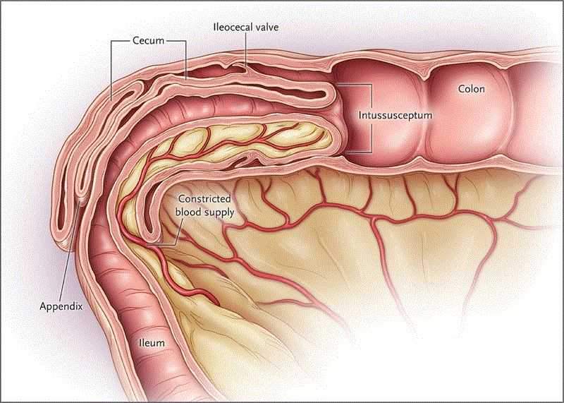 35岁卵巢早衰治好的可能性，35岁卵巢早衰想生育，只能考虑做供卵试管婴儿吗？