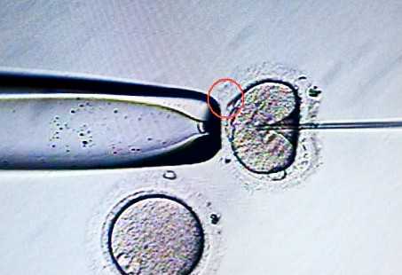 大连妇产医院做试管要多久能做完呀，大连妇产医院做试管要多久能做完？ 