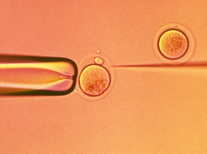北医三院人工授精前检查项目，北医三院供精人工授精每个周期都要选精源吗？ 