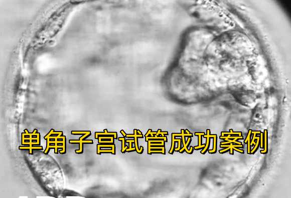 江西省妇幼保健院做试管婴儿成功率高吗?，「医院导航」第三代试管婴儿指南之江西省妇幼保健院