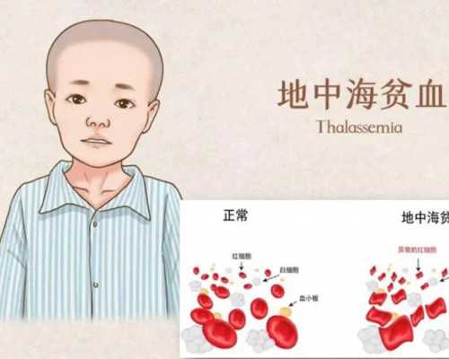 网上无创dna结果查询，无创dna检查的报告结果怎么在手机上查询？ 