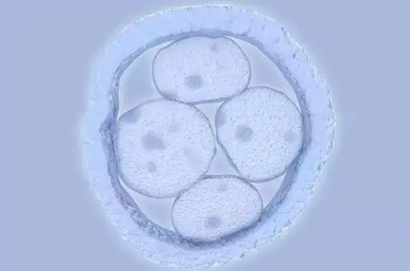 一岁佝偻病，1岁婴儿佝偻病睡姿图片分享，依图判断准确又快捷！