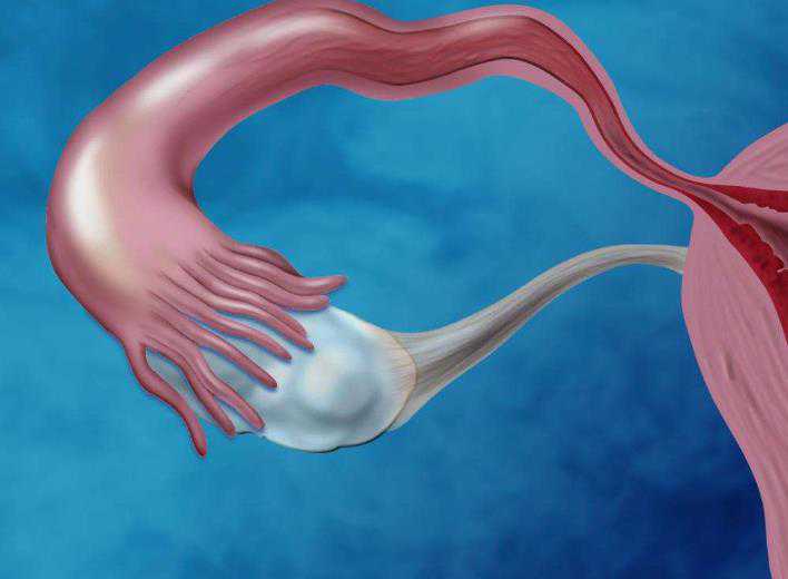 俄罗斯做试管婴儿经历，防坑指南|到俄罗斯做试管婴儿别陷入这3大骗局