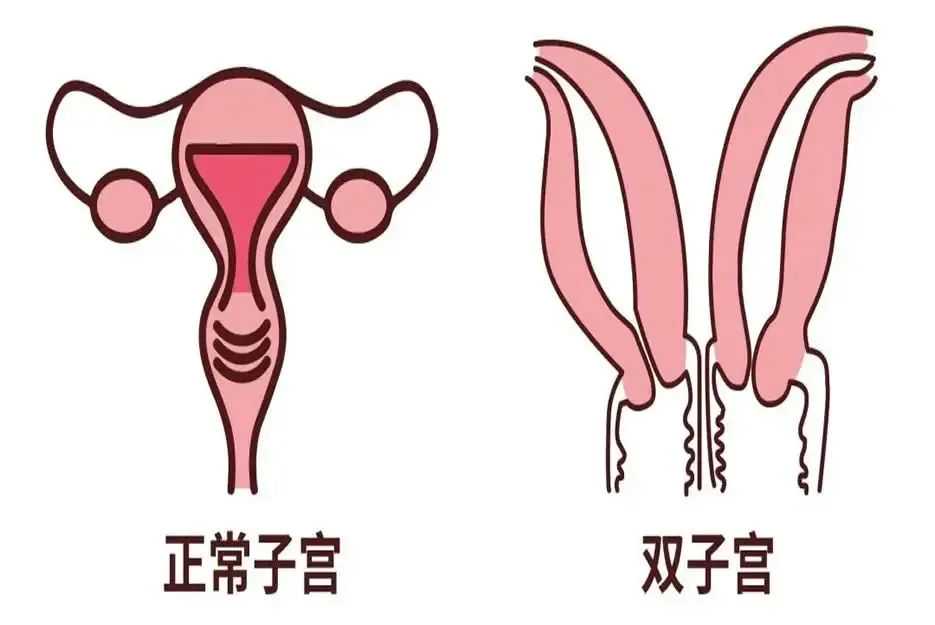 怀孕空孕囊是什么，怀孕空孕囊有4大典型症状，妊娠反应消失为其一