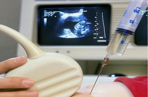 打了国产二价疫苗后有什么不良反应，为啥很多姐妹都后悔打完国产二价hpv疫苗了？ 